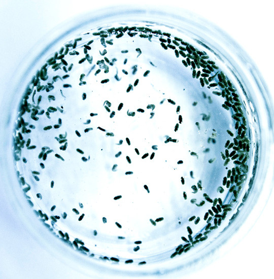 Illustrasjonsfoto: Science Photo Library