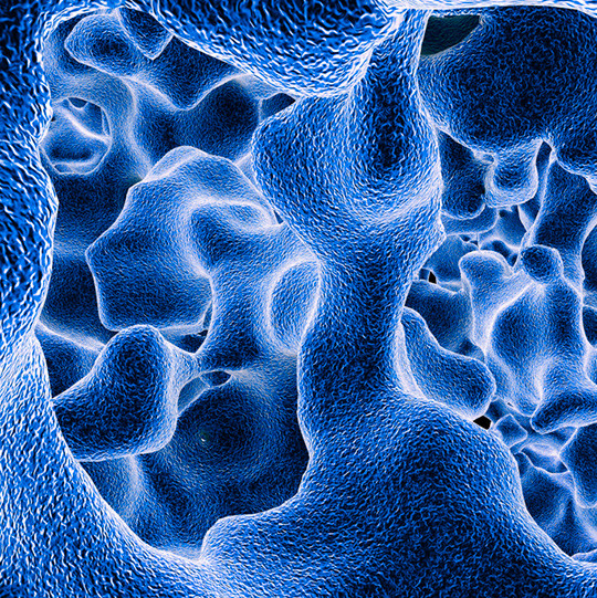 Illustrasjonsfoto: Science Photo Library