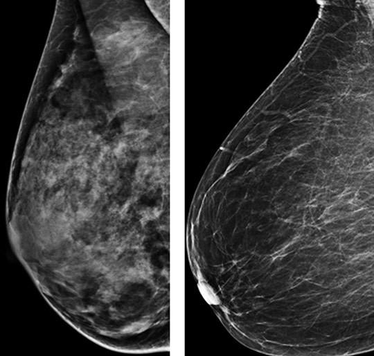 Illustrasjonsfoto: Ap/Scanpix