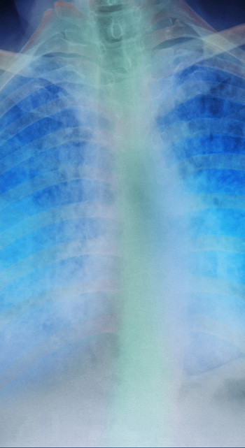 Illustrasjonsfoto: Science Photo Library