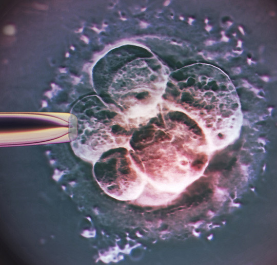 Illustrasjonsfoto: Science Photo Library