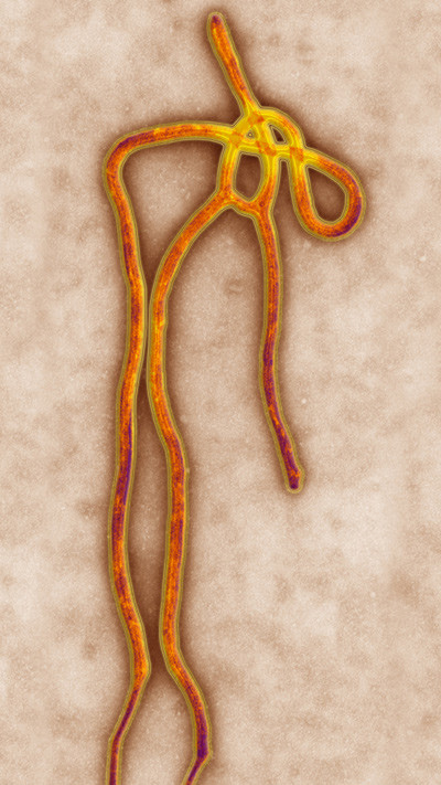 Illustrasjonsfoto: Science Photo Library