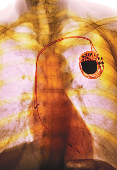 Illustrasjonsfoto: Science Photo Library