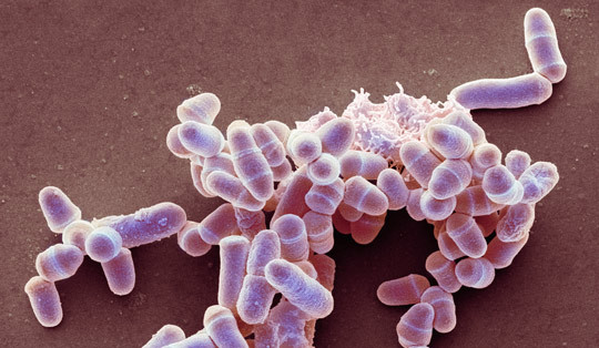 Illustrasjonsfoto: Science Photo Library