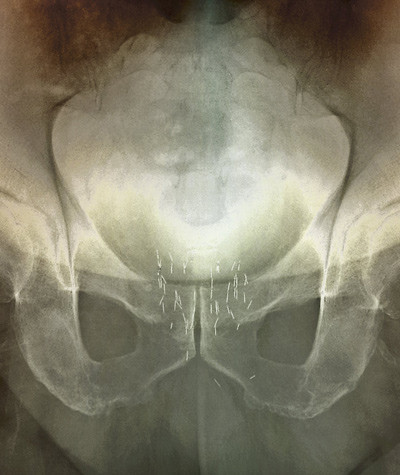 Illustrasjonsfoto: Science Photo Library