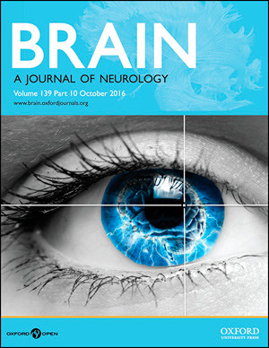 Artikkelen ble f&oslash;rst publisert i tidsskriftet Brain i oktober 2016