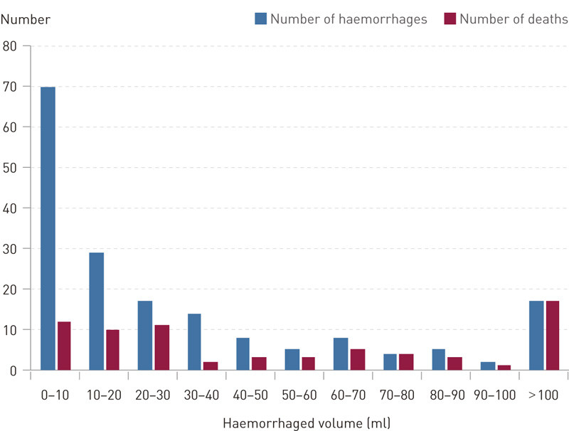 Figure 1  Haemorrhaged volume in ml measured by a CT scan upon admission and 90-day mortality in persons with a first-time&hellip;