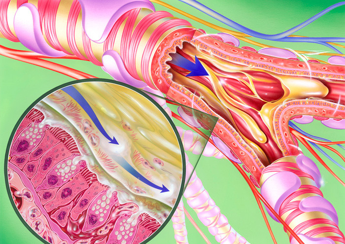 Bronkiene hos en kolspasient. Foto: Science Photo Library