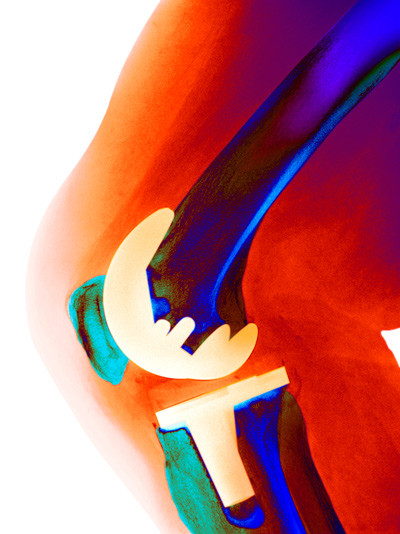 Illustrasjonsfoto: Science Photo Library