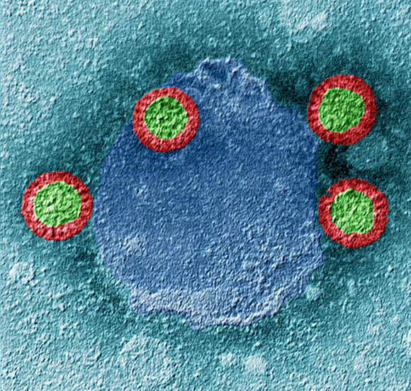 Illustrasjonsfoto: Science Photo Library