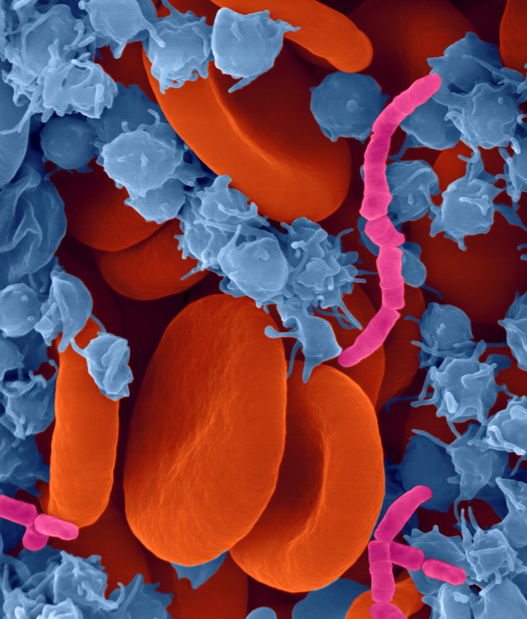 Illustrasjonsfoto: Science Photo Library