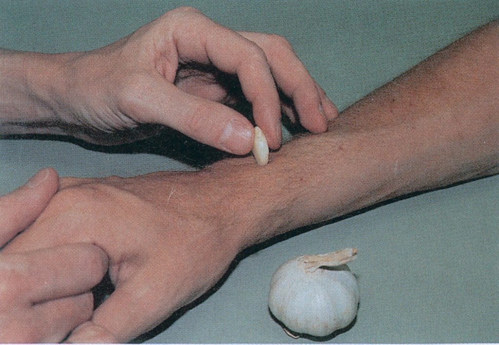 Figur 8 En av forfatterne gjorde tjeneste som &aring;te. Den ene h&aring;nden ble grundig innsmurt med hvitl&oslash;k, den andre var helt ren