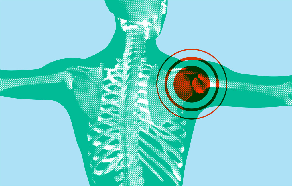 Illustrasjonsfoto: iMrSquid/iStock.