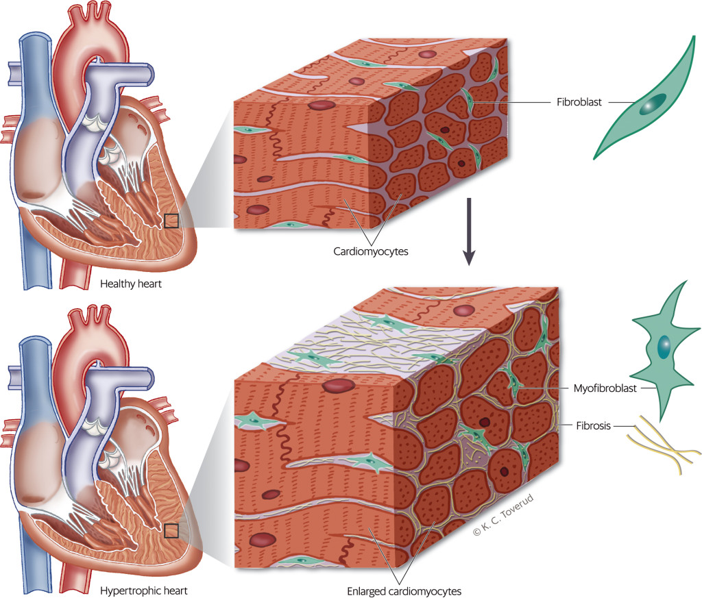 Figure 2 Fibroblasts are located among cardiomyocytes, where they ensure the correct quantity and composition of&hellip;