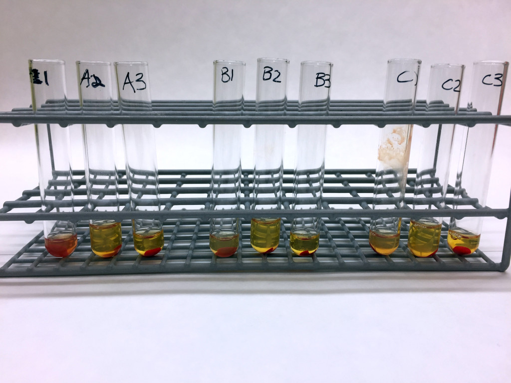 Figure 1 The whole set-up for the Donath-Landsteiner test. There is haemolysis in test tube A1, which is consistent with a&hellip;