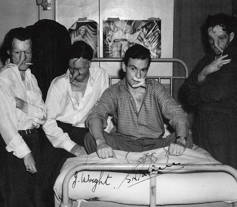 Figur 3 Pasienter med avstandslapper (trunks). Foto: East Grinstead Museum