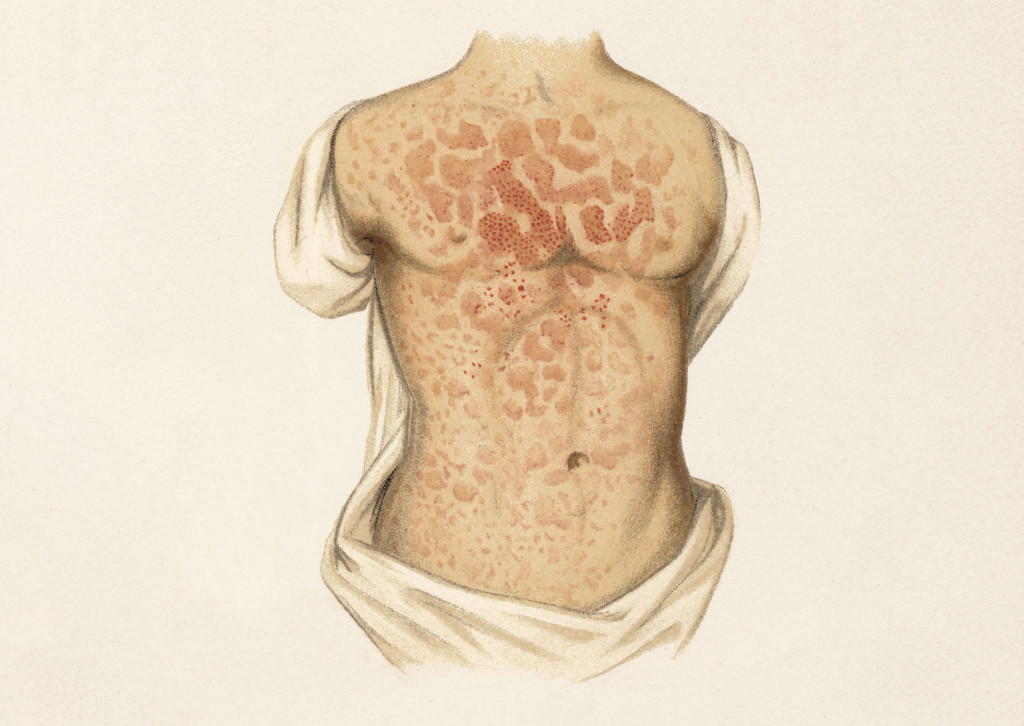 Illustrasjon: ZU_09/iStock