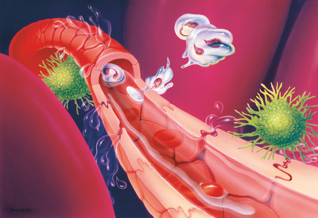 Blod&aring;re under septisk sjokk. Science photo library / NTB Scanpix