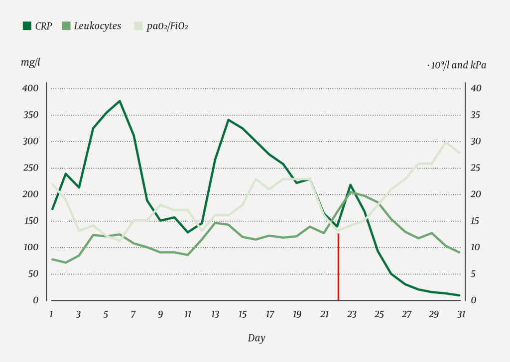 Figure 1 Inflammation parameter measurements and oxygenation requirement from the time of initial hospitalisation: CRP value&hellip;