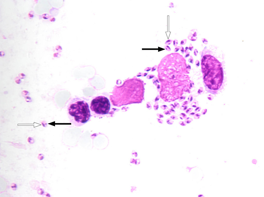 Figure 1 Light microscopy of spleen biopsy from patient with Leishmania amastigotes, in which the cell nucleus can be seen &hellip;