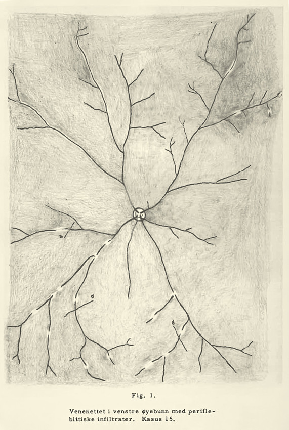 Figure 2 From Marius Haarr's doctoral thesis