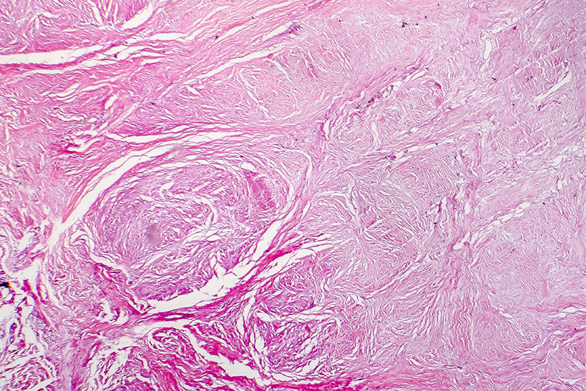 Fibr&oslash;st vev. Illustrasjon: Dr Microbe / iStock