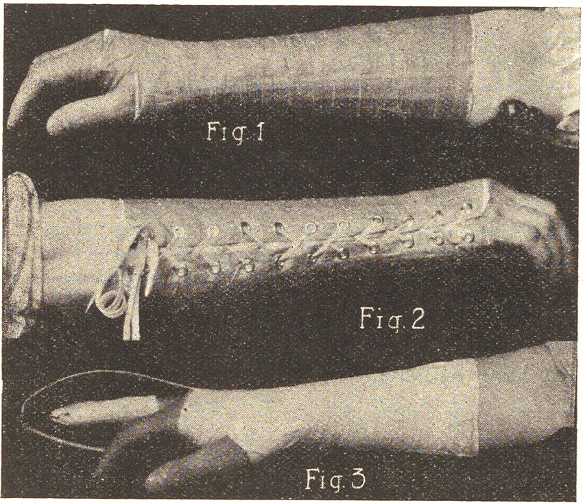 Illustrasjon fra faksimile.