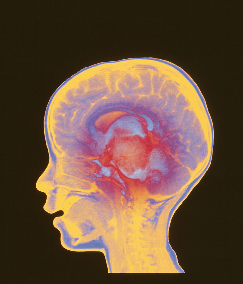 Foto: Science Photo Library / NTB