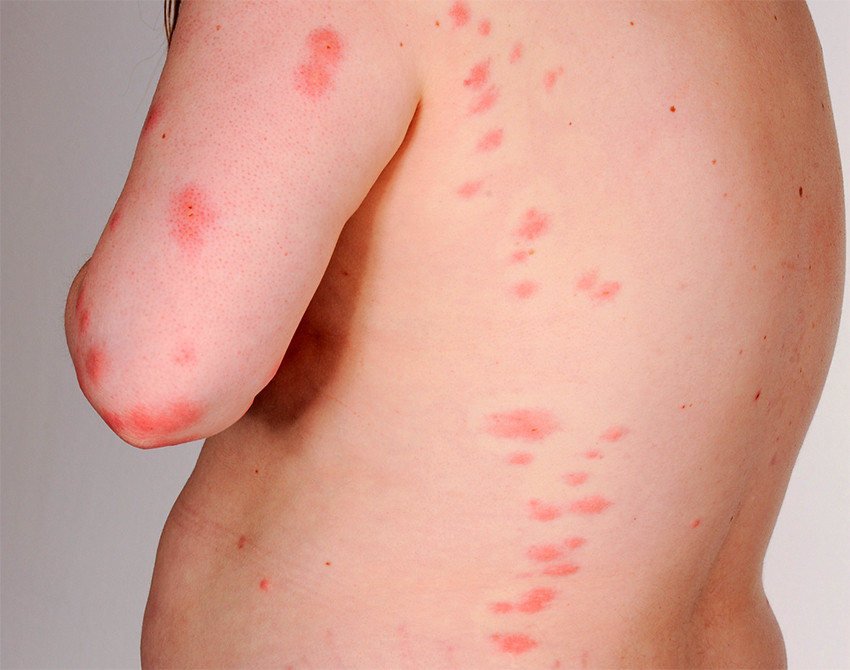 Foto: &Oslash;ystein Horgmo, Universitetet i Oslo