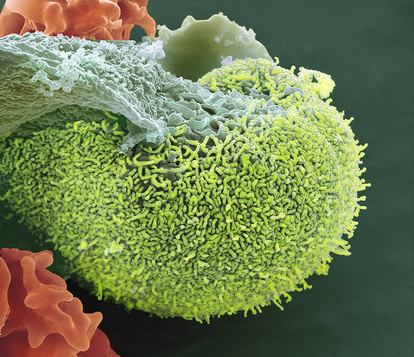 Illustrasjon: Science Photo Library / NTB