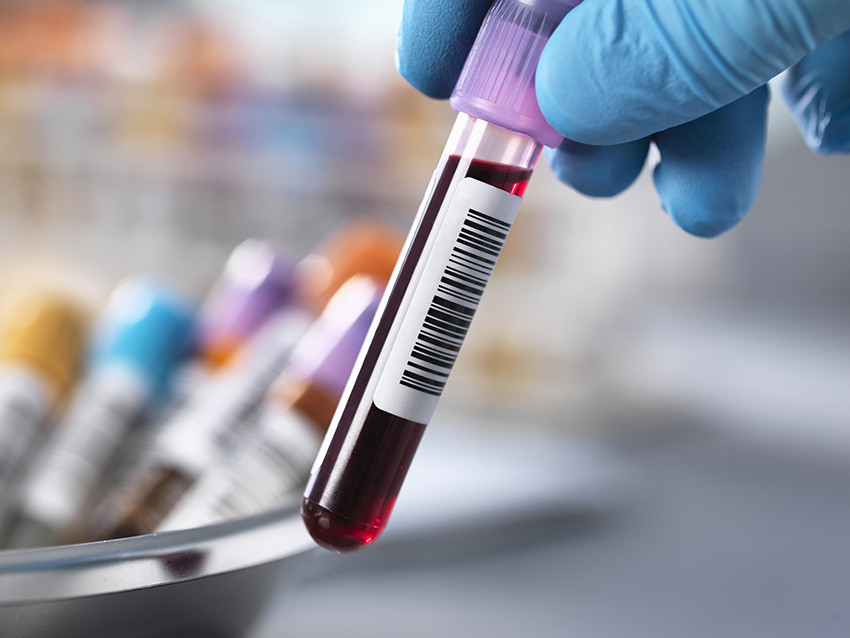 Foto: Science Photo Library / NTB