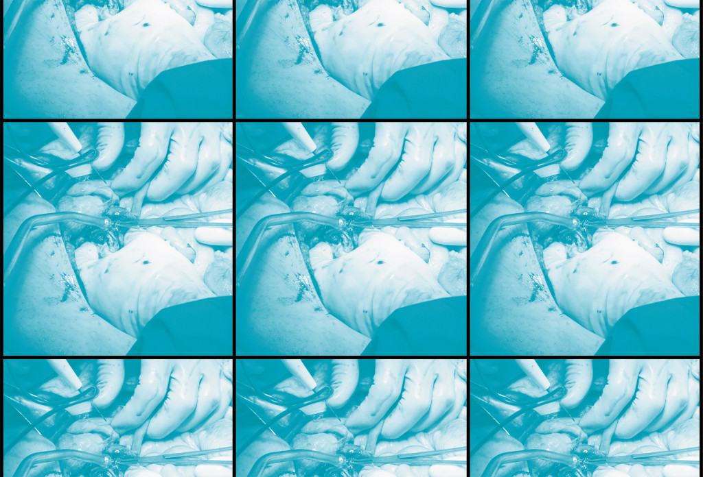 Illustration: Science Photo Library / NTB. Adapted by the Journal of the Norwegian Medical Association.