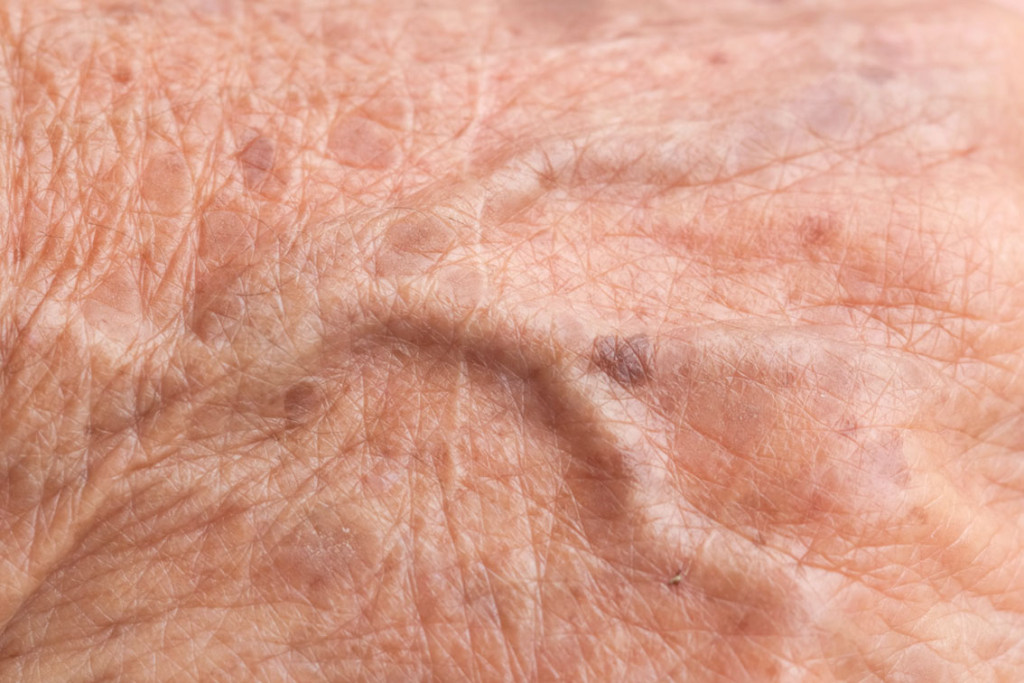 Illustrasjonsfoto: tuk69tuk/iStock