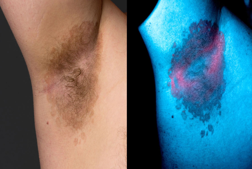 Foto: &Aring;sne Ramb&oslash;l Hillestad, Foto- og videotjenesten, Institutt for klinisk medisin, Universitetet i Oslo