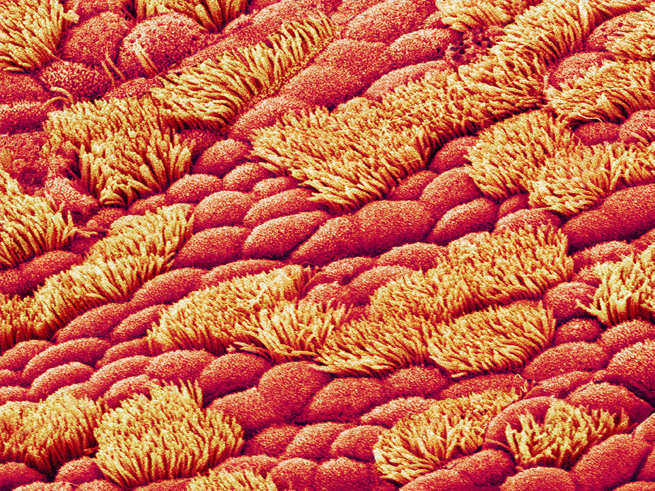 Neseslimhinne. Et farget bilde fra skanningelektronmikroskop (SEM) av flimmerh&aring;r som dekker epitelkledningen i nesehulen&hellip;