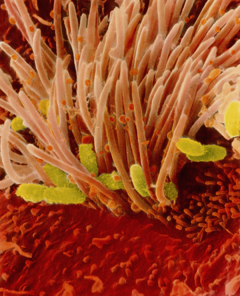 Bordetella pertussis, the bacterium that causes pertussis. Scanning electron microscopy shows the bacterium (green) in the&hellip;