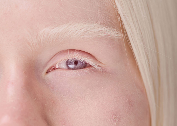 Foto: AnnaStills/iStock. Tilpasset av Tidsskriftet